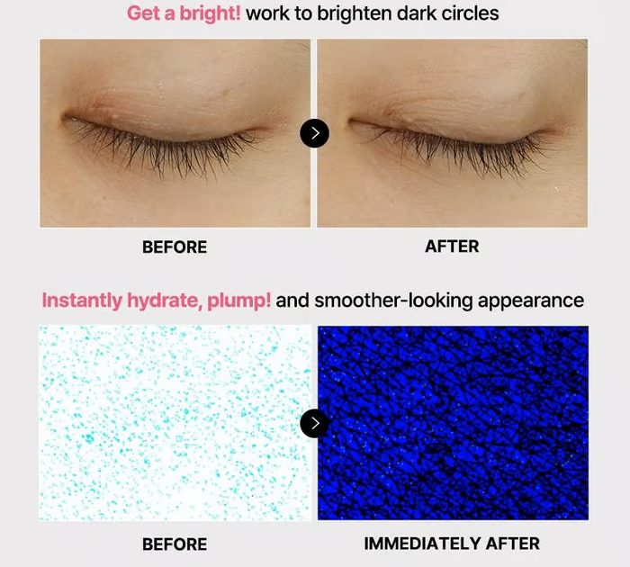 💦 Only $15.99! Last day of the promotion! ⭐-💥 The peptide collagen hydrogel eye patch